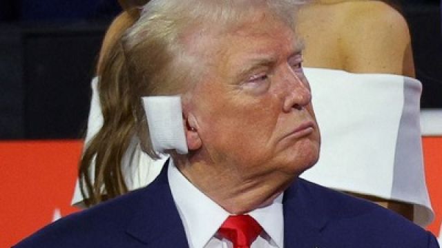 Injured-Donald-Trump-is-bandaged.jpg